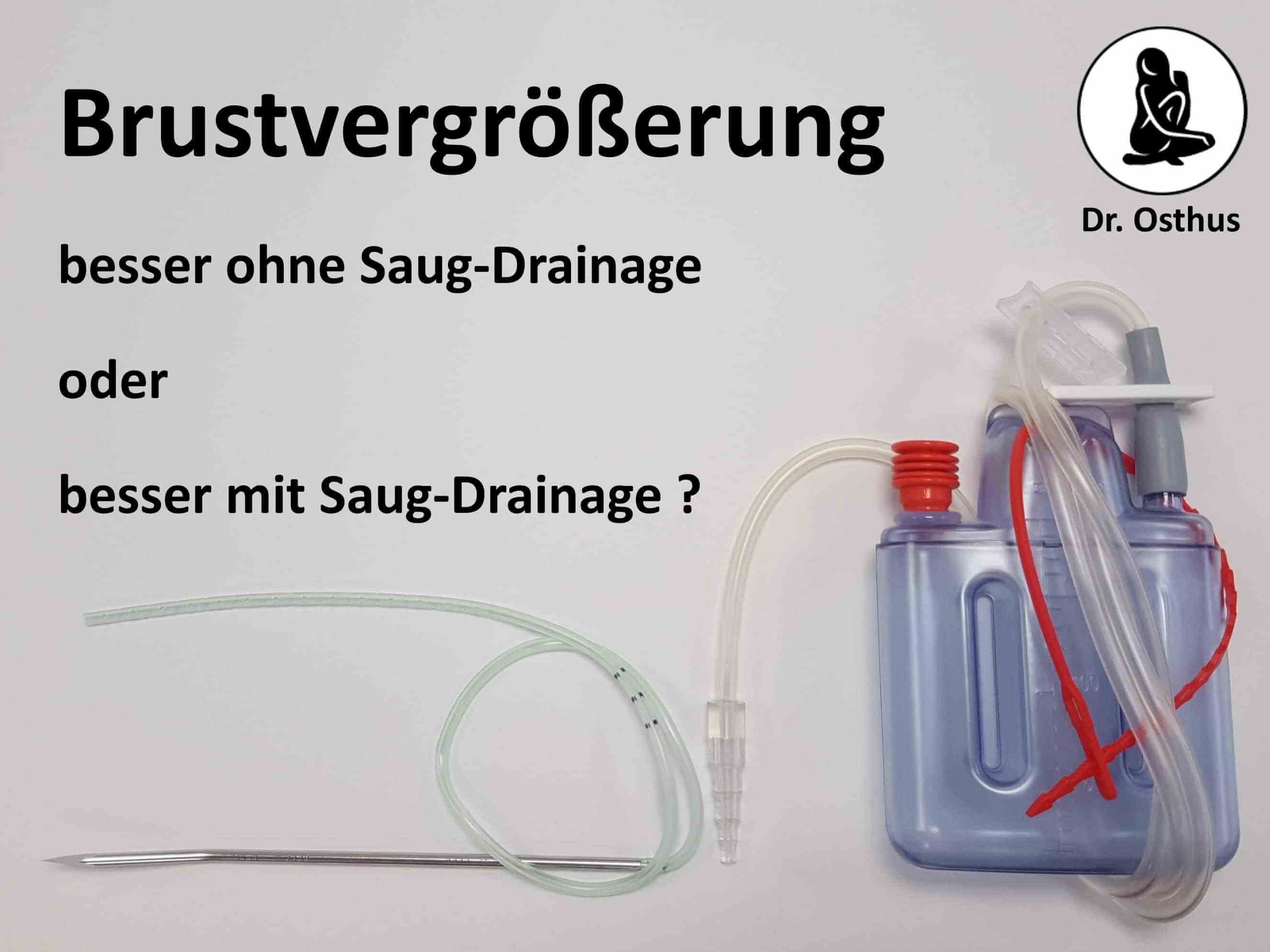Brustvergrößerung ohne Drainage oder mit Drainage zum Entfernen von Wundwasser