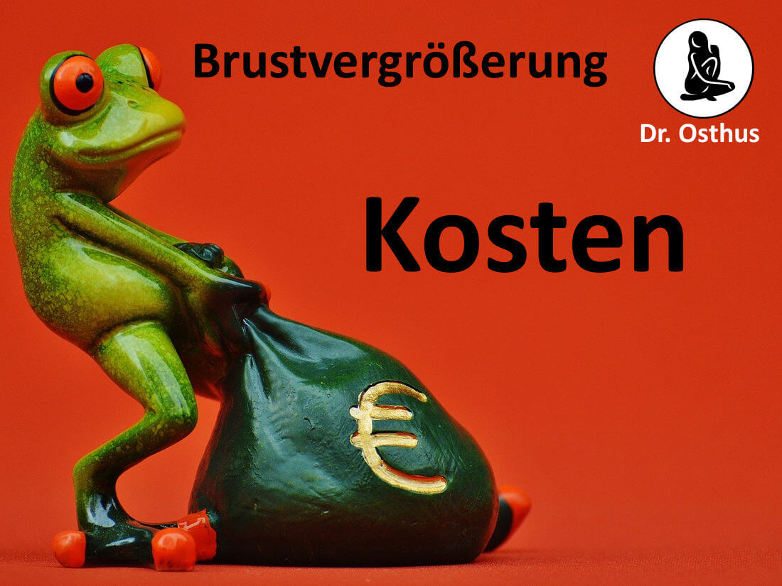 Brustvergrößerung Kosten