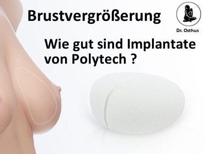 Qualität der Implantate von Polytech zur Brustvergrößerung