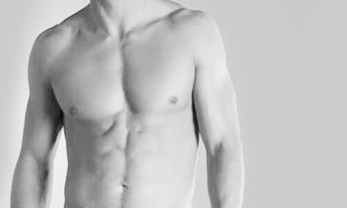 Gynäkomastie - Brustverkleinerung beim Mann